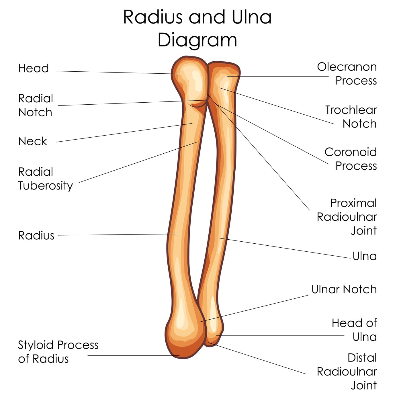 Cannot Supinate? Range of Motion Problem OR Proximal Radioulnar Joint Problem?