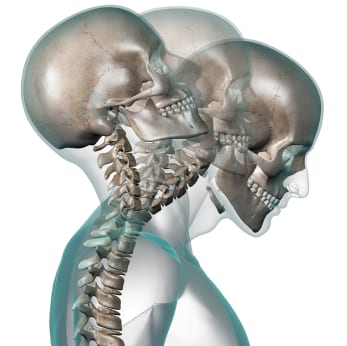 Is One Better Than The Other?: A Randomized Clinical Trial of Manual Therapy for Patients with Chronic Neck Pain