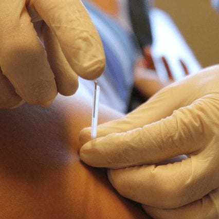 New perspectives on dry needling following a medical model: are we screening our patients sufficiently?