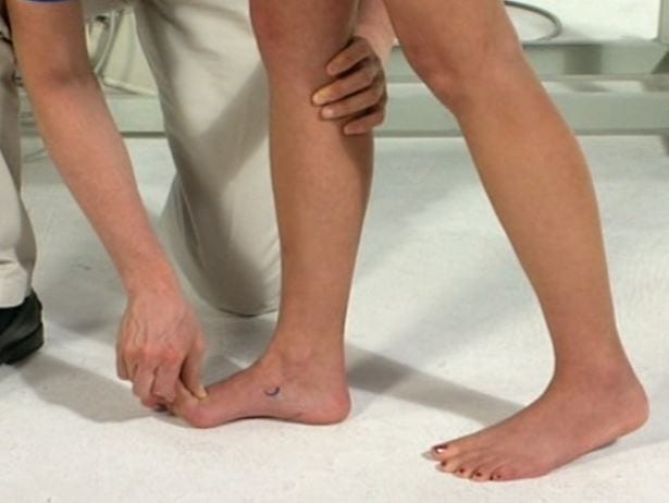 Pain on the Plantar Surface of the Foot: Review Article