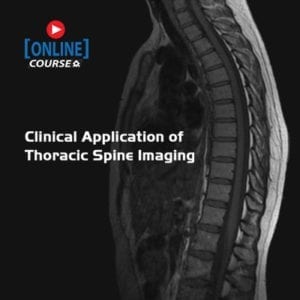 Clinical Application of Thoracic Spine Imaging
