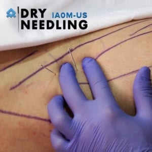 Dry Needling Level I – Hermantown MN – Apr 2025