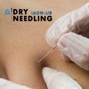 Dry Needling for Pelvic Rehabilitation – Lacy WA – Oct 2025