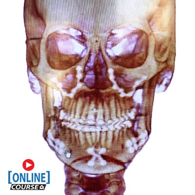 Temporomandibular joint disorders Online website copy