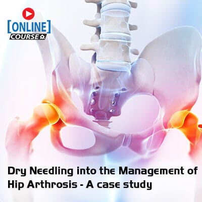 big-Dry Needling into the Management of Hip Arthrosis – A case study Online website copy